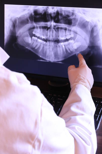Best Broken or Chipped Tooth Repair in Terrytown, LA